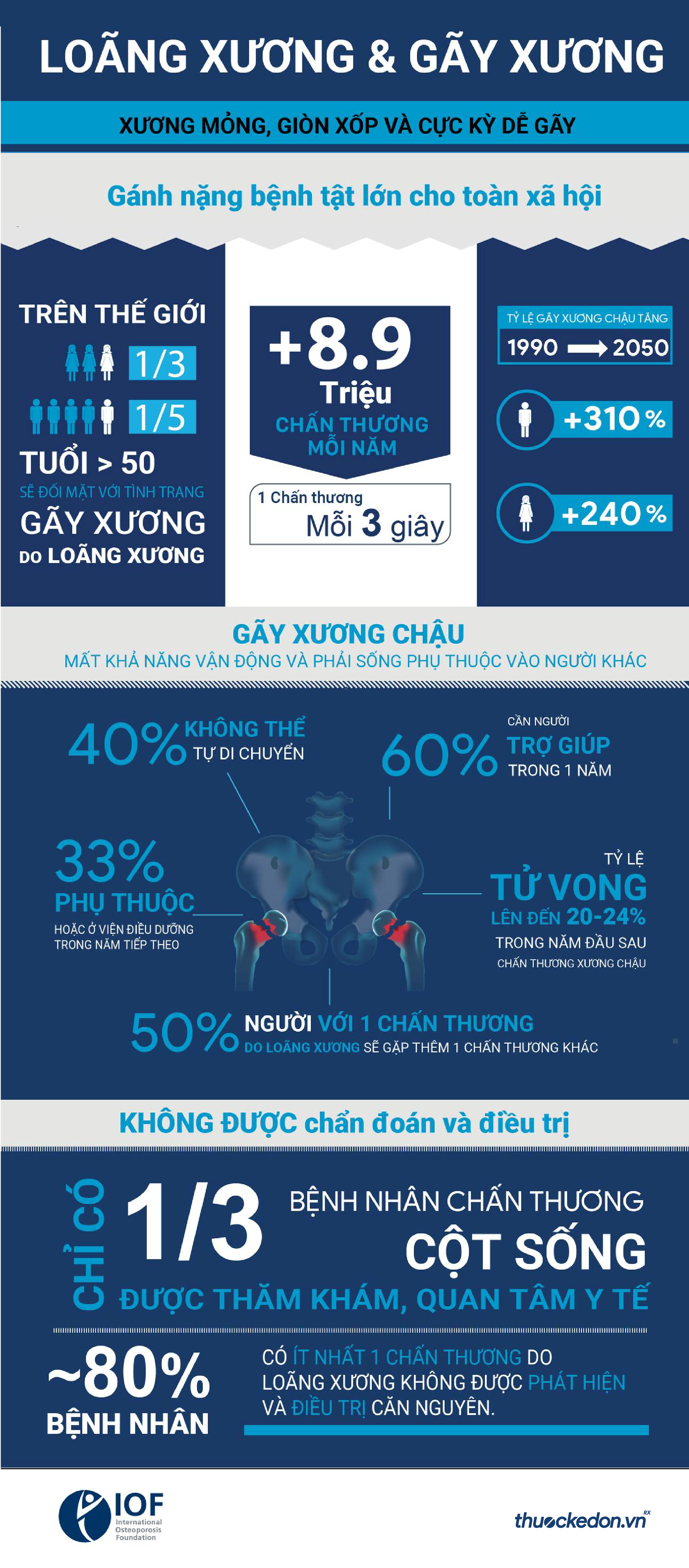 Loãng xương và gãy xương