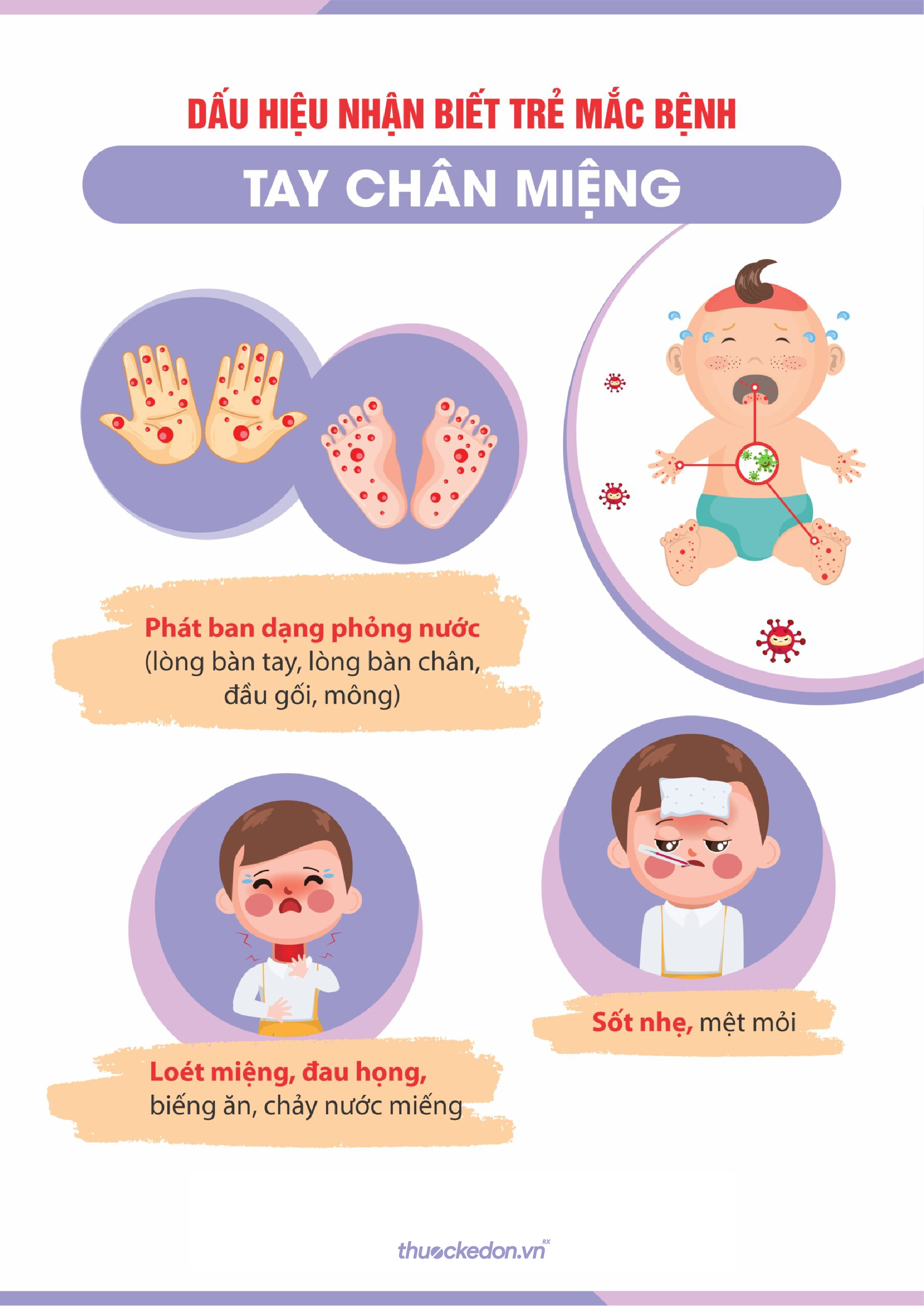 Tay chân miệng